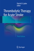 Bild: Thrombolytic Therapy for Acute Stroke - Springer