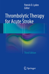 Bild: Thrombolytic Therapy for Acute Stroke - Springer