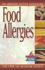 Cover: Food Allergies - Trade Paper Press