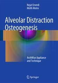 Abbildung von: Alveolar Distraction Osteogenesis - Springer