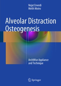 Abbildung von: Alveolar Distraction Osteogenesis - Springer