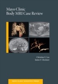 Abbildung von: Mayo Clinic Body MRI Case Review - OUP eBook