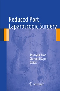 Abbildung von: Reduced Port Laparoscopic Surgery - Springer