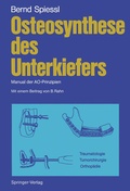 Cover: Osteosynthese des Unterkiefers - Springer