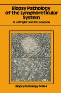 Cover: Biopsy Pathology of the Lymphoreticular System - Chapman and Hall