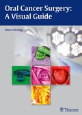 Cover: Oral Cancer Surgery - Thieme