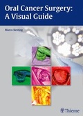 Cover: Oral Cancer Surgery - Thieme