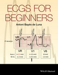 Abbildung von: ECGs for Beginners - Wiley-Blackwell