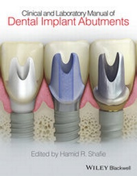 Abbildung von: Clinical and Laboratory Manual of Dental Implant Abutments - Wiley-Blackwell