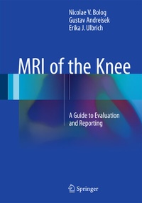 Abbildung von: MRI of the Knee - Springer