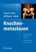 Cover: Knochenmetastasen - Springer