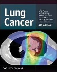 Enlarge image Cover: Lung Cancer 4e - Wiley