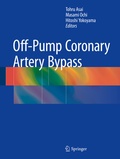 Bild: Off-Pump Coronary Artery Bypass - Springer