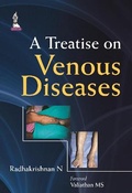 Cover: A Treatise on Venous Diseases - Jaypee Brothers Medical Publishers