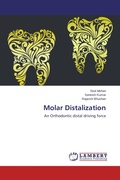 Cover: Molar Distalization - LAP Lambert Academic Publishing
