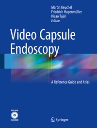Abbildung von: Video Capsule Endoscopy - Springer