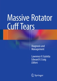 Abbildung von: Massive Rotator Cuff Tears - Springer