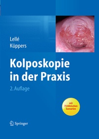 Bild vergrößern Bild: Kolposkopie in der Praxis - Springer