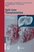 Cover: Split Liver Transplantation - Springer