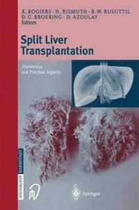 Enlarge image Cover: Split Liver Transplantation - Springer