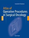 Cover: Atlas of Operative Procedures in Surgical Oncology - Springer