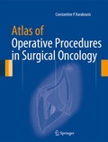 Cover: Atlas of Operative Procedures in Surgical Oncology - Springer New York