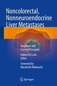 Abbildung von: Noncolorectal, Nonneuroendocrine Liver Metastases - Springer