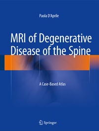 Abbildung von: MRI of Degenerative Disease of the Spine - Springer