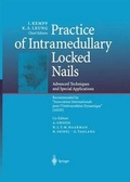 Cover: Practice of Intramedullary Locked Nails - Springer