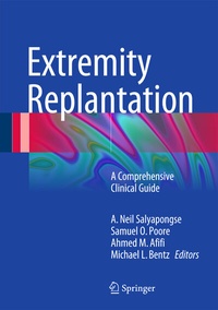 Abbildung von: Extremity Replantation - Springer