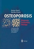 Cover: Osteoporosis - Springer