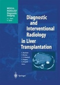 Cover: Diagnostic and Interventional Radiology in Liver Transplantation - Springer