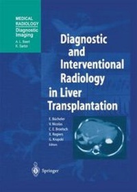 Enlarge image Cover: Diagnostic and Interventional Radiology in Liver Transplantation - Springer