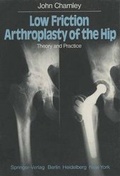 Cover: Low Friction Arthroplasty of the Hip - Springer