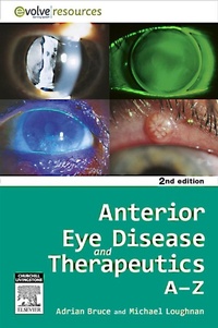 Abbildung von: Anterior Eye Disease and Therapeutics A-Z - E-Book - Elsevier