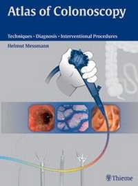 Abbildung von: Atlas of Colonoscopy - Thieme