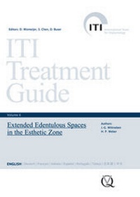 Abbildung von: Extended Edentulous Spaces in the Esthetic Zone - Quintessenz Verlag