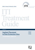 Cover: Implant Placement in Post-Extraction Sites - Quintessenz Verlag