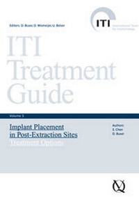 Enlarge image Cover: Implant Placement in Post-Extraction Sites - Quintessenz Verlag