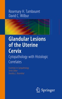 Abbildung von: Glandular Lesions of the Uterine Cervix - Springer