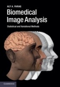 Abbildung von: Biomedical Image Analysis - Cambridge University Press