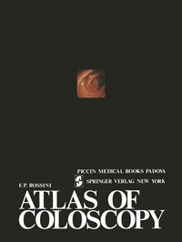 Abbildung von: Atlas of coloscopy - Springer