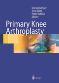Cover: Primary Knee Arthroplasty - Springer