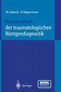 Cover: Kompendium der traumatologischen R&ouml;ntgendiagnostik - Springer