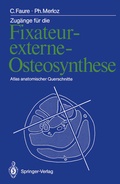 Cover: Zug&auml;nge f&uuml;r die Fixateur-externe-Osteosynthese - Springer