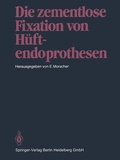 Cover: Die zementlose Fixation von H&uuml;ftendoprothesen - Springer