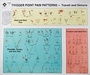 Cover: Travell and Simons' Trigger Point Pain Patterns Wall Charts - Lippincott Williams and Wilkins
