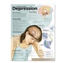 Cover: Understanding Depression Anatomical Chart - Lippincott Williams and Wilkins