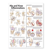Abbildung von: Hip and Knee Inflammations Anatomical Chart - Lippincott Williams and Wilkins
