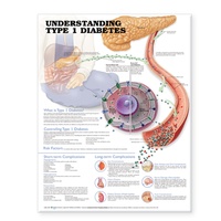 Abbildung von: Understanding Type 1 Diabetes Anatomical Chart - Lippincott Williams and Wilkins